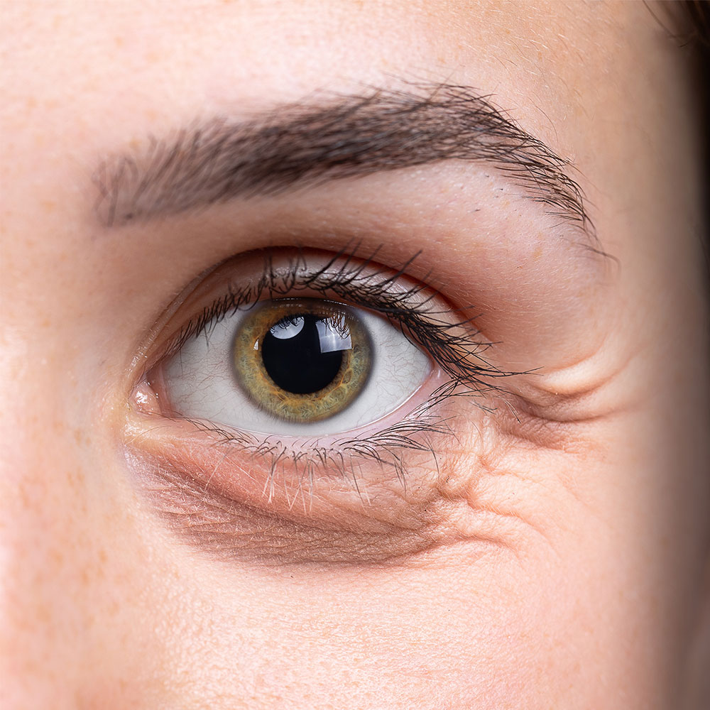Injectable treatment