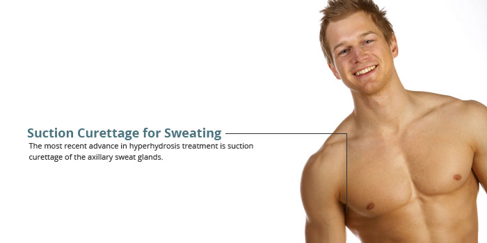 Christchurch Suction Curettage For Excessive Sweating Km Surgical Nz